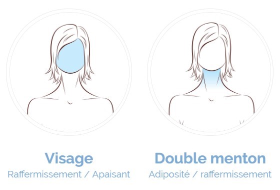 cryothérapie visage et double menton