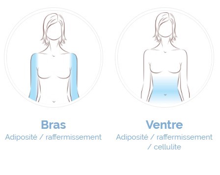 cryothérapie bras et ventre