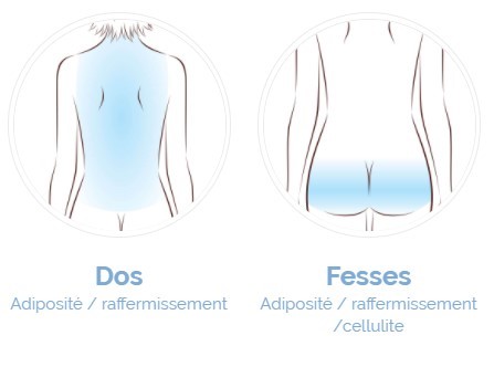 cryothérapie dos et fesses